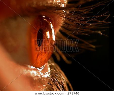 Eye