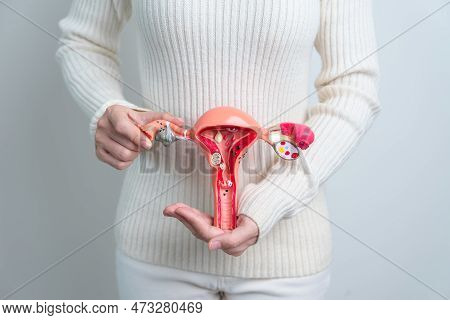 Woman Holding Uterus And Ovaries Model. Ovarian And Cervical Cancer, Cervix Disorder, Endometriosis,