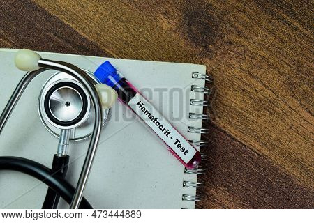 Concept Of Hematocrit - Test With Blood Sample. Healthcare Or Medical Concept