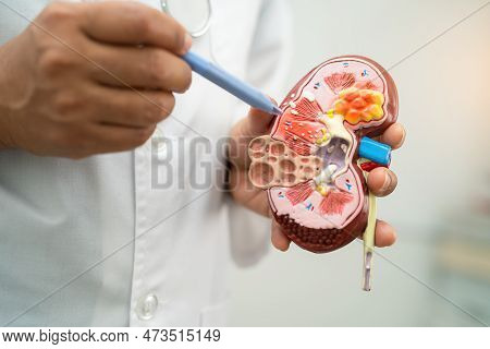 Kidney Disease, Chronic Kidney Disease Ckd, Doctor Hold Model To Study And Treat In Hospital.