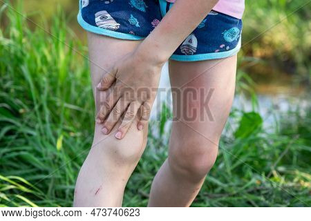 Girl Uses A Remedy For Mosquitoes And Biting Insects In Nature. Protection Of The Skin From Tick Bit