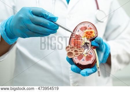 Kidney Disease, Chronic Kidney Disease Ckd, Doctor Hold Model To Study And Treat In Hospital.