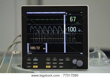 Ecg Monitor