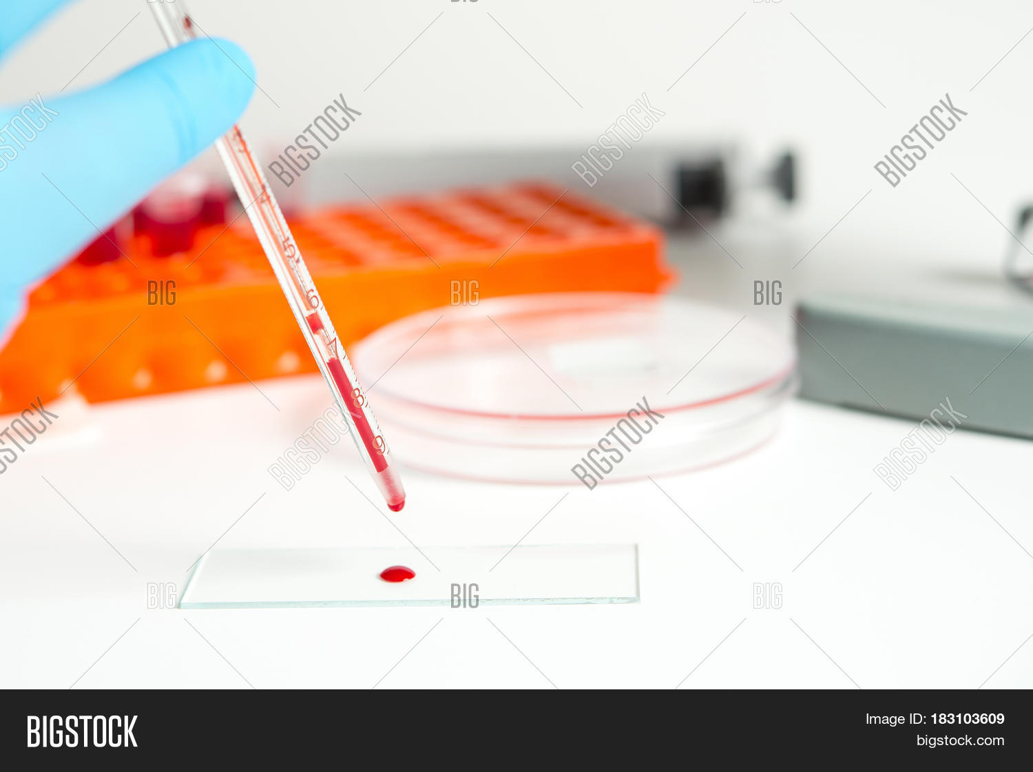 Drop Blood Test Tube Image & Photo (Free Trial) Bigstock