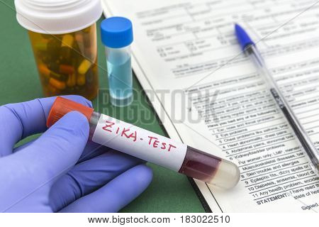 Scientist with blue latex gloves holds vials of ZIKA virus in laboratory for analysis