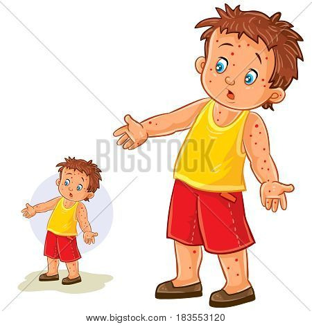 Vector illustration of a little boy with a rash on his hands and legs, chickenpox, smallpox, allergies. Print
