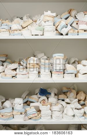 Piles of dentures lying on each other on several shelves close up shot in medical centre