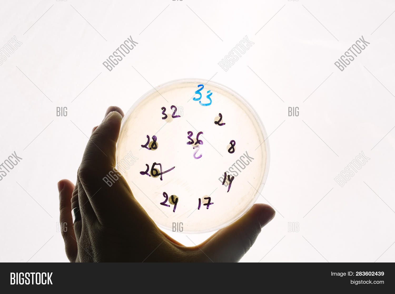Hand Holds Petri Dish Image Photo Free Trial Bigstock
