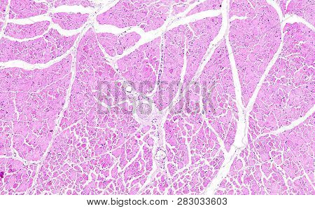 Histology Of Human Tissue, Show Necrosis Of Skeletal Muscle As Seen Under The Microscope, 10x Zoom