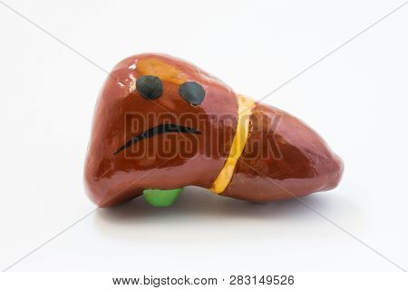 Concept Photo Of Unhappy, Sad Liver With Sickness Disorder. Model Of Liver Gallbladder  With Sad Smi