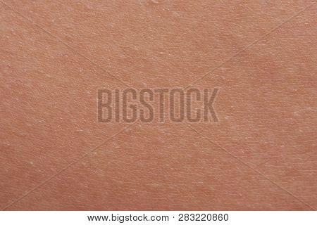 Texture Background Of Flat Human Skin Macro Close-up