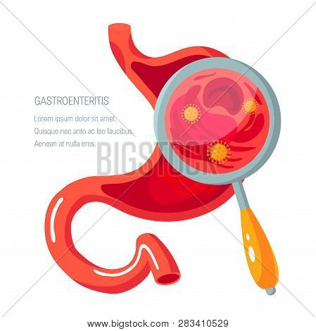 Gastroenteritis Concept. Human Stomach On Fire. Vector Illustration In Flat Style.