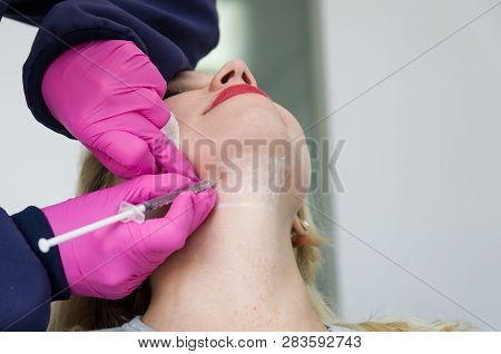 Great Concept Of Aesthetic Treatment Of Jowls, Injection Of Deoxycholic Acid.