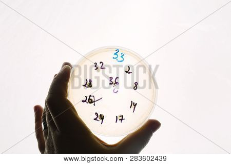 Hand Holds Petri Dish With E.coli Escherichia Bacteria. Lab Testing For Intestinal Infection.bacteri