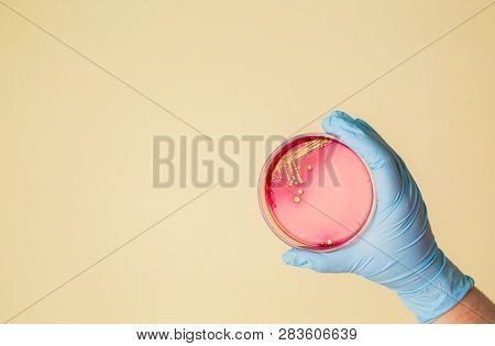 Hand Holds Petri Dish With Staphylococcus Aureus Bacteria. Medical Lab Testing For Infection.bacteri