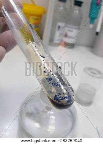Grown Colonies Of Gonorrhea (neisseria Gonorrhoeae) In Test Tube After A Positive Reaction To Cytoch