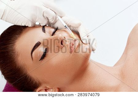 Portrait Of Beautiful Woman Gets Injection Of Botox In Her Lips. Closeup Hand In Glove With Syringe 