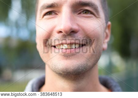 Yellow Damaged Tooth Of A Smiling Caucasian Man In Close-up. Focus On The Teeth. Dental Problems, De