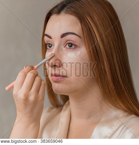 Acne And Post Acne Skin, Scars, Skin Care. Concept Of Beauty, Girl Put On Make Up On A Problem Skin