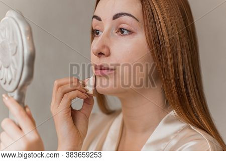 Acne And Post Acne Skin, Scars, Skin Care. Concept Of Beauty, Girl Put On Make Up On A Problem Skin