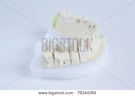 Ceramic Crowns On A Mold