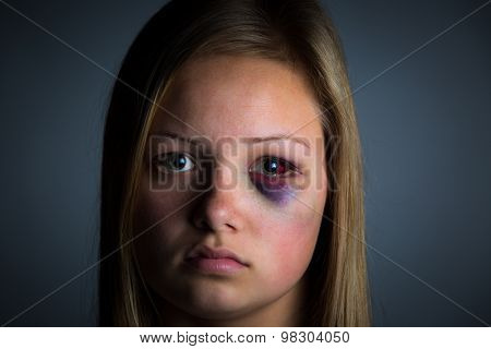 Young girl victim