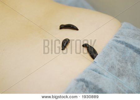 피 빠는 Leechs