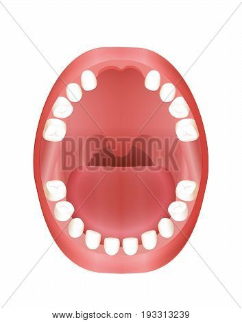 Front teeth missing - illustration of a childs mouth with primary dentition - isolated vector on white background.