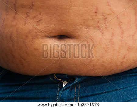 Fat man with a big belly. weightloss