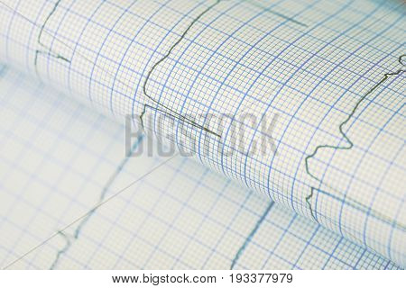 Bended ECG chart as a medical background.