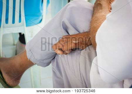 closeup hand of old asian man suffering from leprosy amputated hand