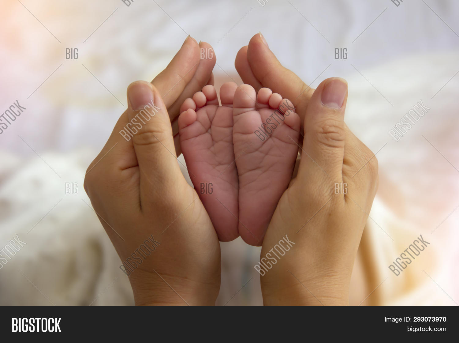 large hands and feet in newborns