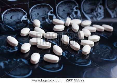 White Pharmaceutical Medicine Pills On Magnetic Brain Resonance Scan Mri Background. Pharmacy Theme,