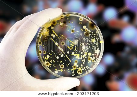 Colonies Of Different Bacteria And Mold Fungi On Petri Dish With Nutrient Agar On The Fungal Backgro