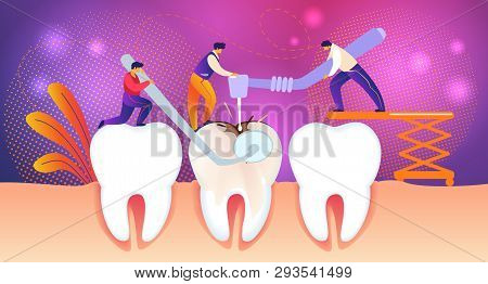 Tiny Dentists Men Treating Giant Unhealthy Tooth With Caries Hole. Men Drilling Plaque. Guy Hold Sto