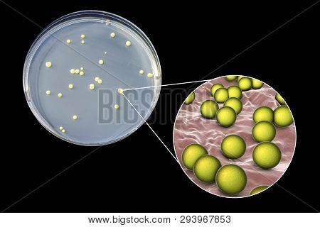 Colonies Of Micrococcus Luteus Bacteria On Agar Plate And Close Up View Of Micrococci Bacteria, Phot