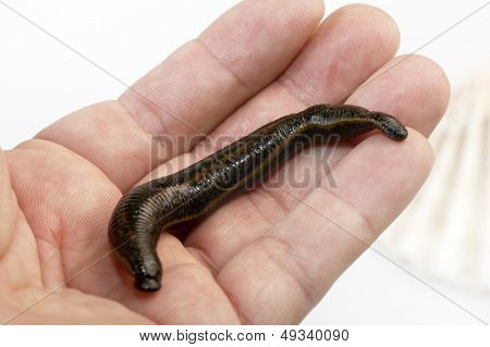 약용 거머리 hirudo medicinalis
