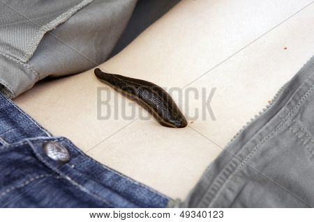 Medicinske Leech-hirudo medicinalis
