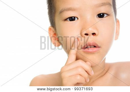 Blood Bleeding From Nose