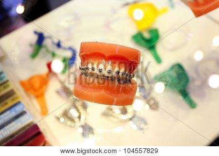Plastic Teeth With Orthodontic Brackets As A Demo.