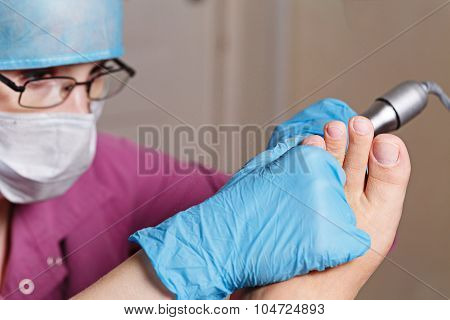 Chiropody Spa Salon. Removal Of Calluses And Corns.