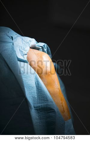Traumatology Orthopedic Surgery Knee Arthroscopy