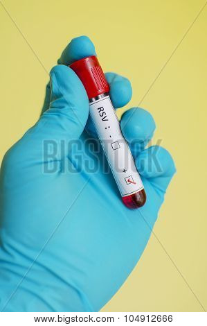 Respiratory syncytial virus (RSV)
