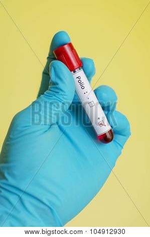 Polio virus positive