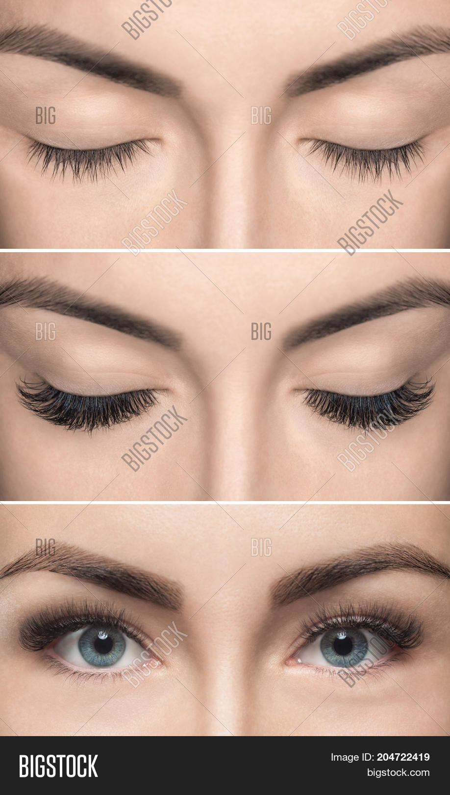 Eyelash Removal Image & Photo (Free Trial) Bigstock