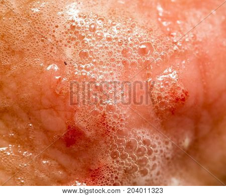 blood on the skin from a cut in hydrogen peroxide .