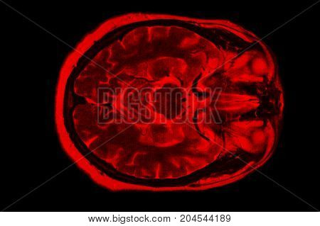 X-ray image of the brain computed tomography, imaging of the brain