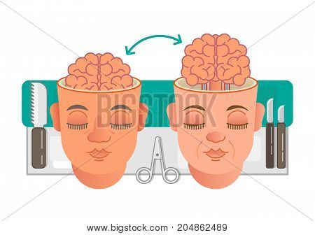 Two illustrated heads showing brain transplantation conceptual illustration