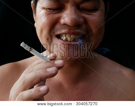 A Man Holding Cigarette. Nicotine Destroy Teeth And Gum Healthy. It Make Effect Yellow Stain, Tooth 