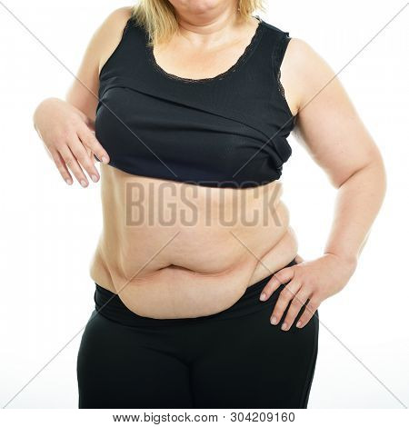 Overweight middle-aged woman shows belly fat, isolated over white background. Overeating xxl size girl dressed in swimsuit unhappy with her figure and overweight